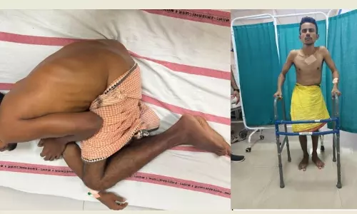 Odisha Man With Severe Spine, Hip Fusion Now Able to Stand And Walk After Complex AIIMS Surgeries Odisha Man With Severe Spine, Hip Fusion Now Able to Stand And Walk After Complex AIIMS Surgeries