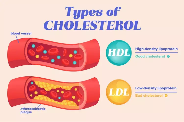 Chandrakant Lahariya | When And How Lipid Levels Can Transform Into A National Anxiety